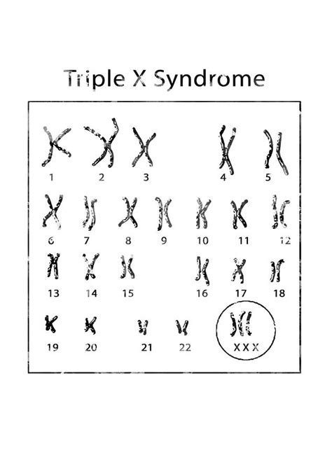 Triple X Syndrome Digital Art By Erzebet S