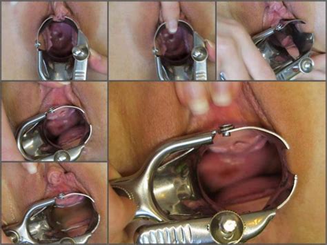unknown large labia girl speculum examination and peeing amateur fetishist