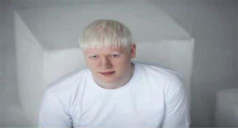 international albinism awareness day