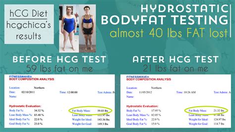 Should You Add Lipo Or Mic Shots To Your Hcg Injections On