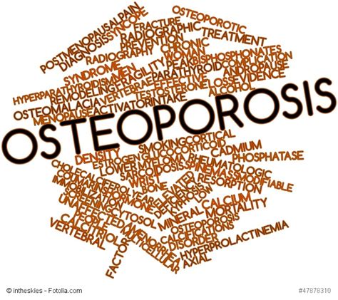 Causes Of Osteoporosis Bone Disease