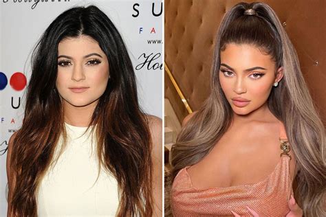 what did kylie jenner look like before and after lip filler the us sun
