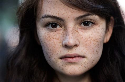 15 Fantastic Freckle Photos [updated]