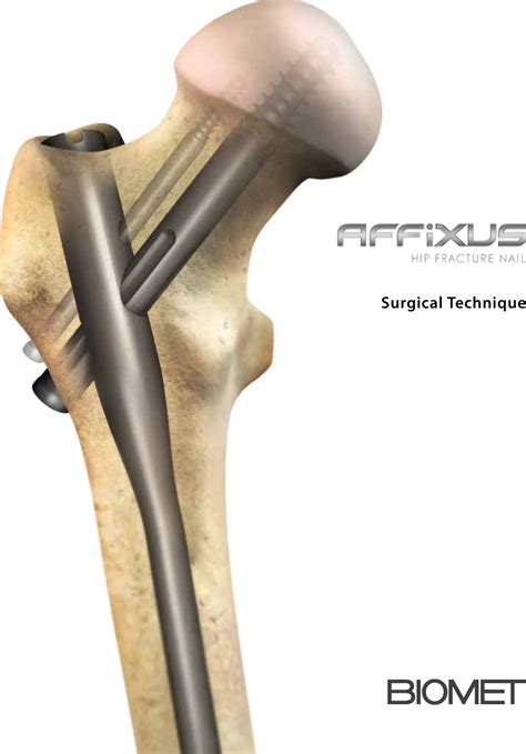 affixus hip fracture nail surgical technique