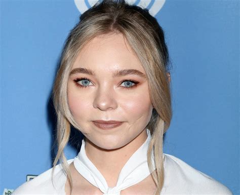 Canadian Actress Taylor Hickson Who Was Disfigured On A
