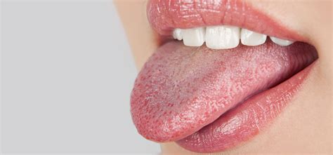 effective home remedies  treat dry mouth