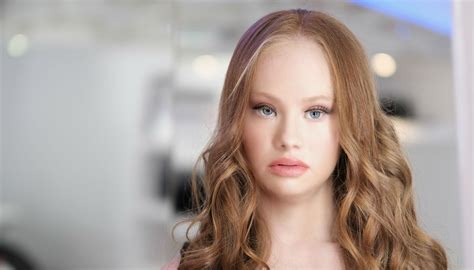 World S First Model With Down Syndrome Proves Diversity Is
