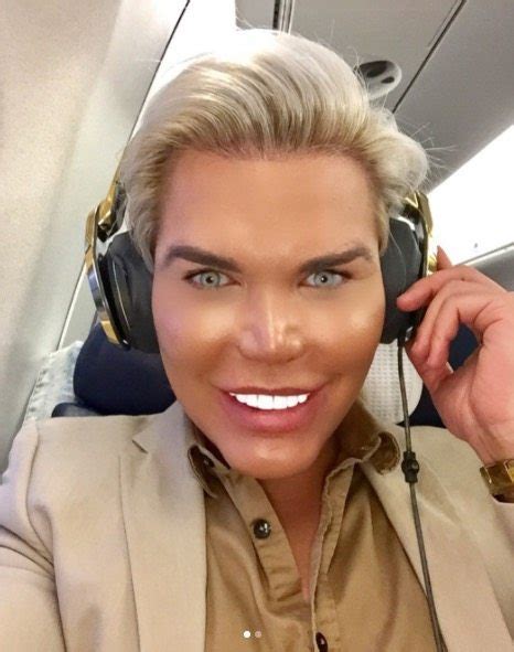 Human Ken Doll Shaken As Teeth Fall Out After Being