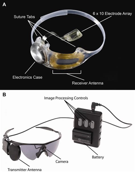 bionic eye implant improves visual function  quality  life neuroscience news