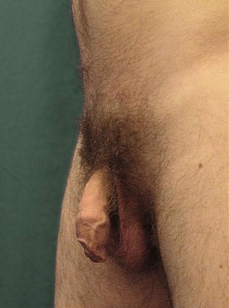 Uncut Cock Soft To Hard Smc33