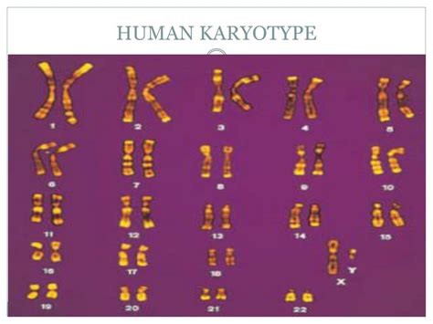 Ppt Chromosome Powerpoint Presentation Free Download Id 2084323