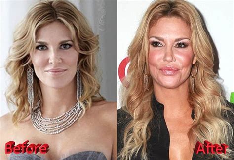 jessa rhodes before and after plastic surgery celebrity