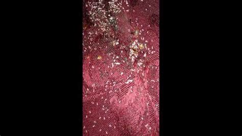 Worst Bed Bug Infestation In Akron Ohio Youtube