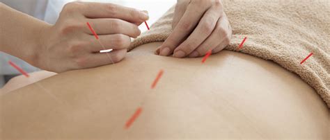 Low Back Pain Wildwood Acupuncture Center