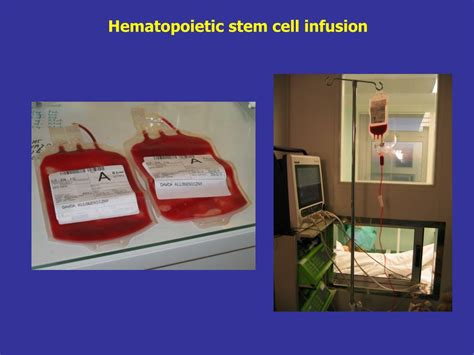 Ppt Hematopoietic Stem Cell Transplantation Powerpoint Presentation