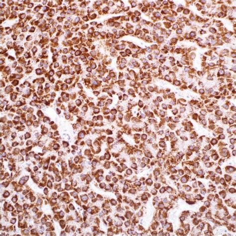 hepatocyte specific antigen hep par ep rabbit monoclonal