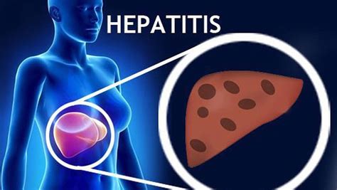 hepatitis  symptoms signs types vaccine treatment cure