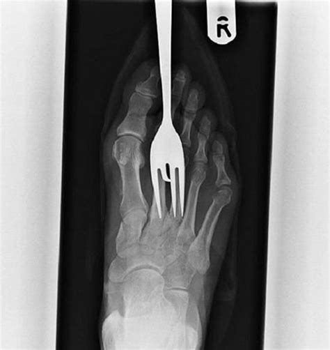 31 Shocking X Ray Images That You Won T Believe Haven T Been Photoshopped