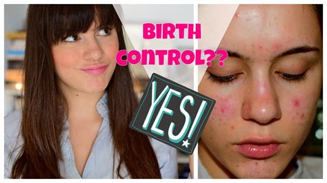 ⭐️ starting birth control acne upate youtube