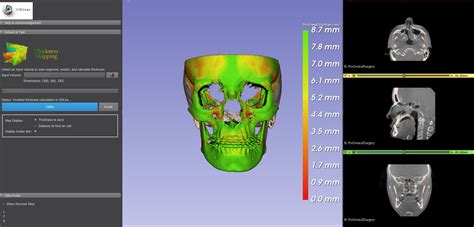github auditory biophysics labslicer bonethicknessmapping  slicer module  creates