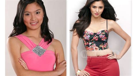 Kim Chiu Before And After Extreme Plastic Surgery