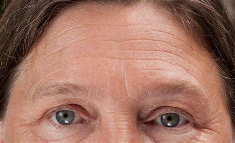 remove forehead lines  face aerobics workouts eradicate