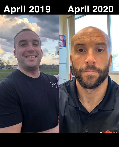 Another Post Of Me From Last Year I Lost 40lbs And Buzzed