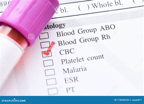 blood  cbc test stock image image  research health
