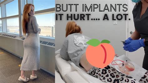 Butt Implants Heres How My First Week Went Youtube