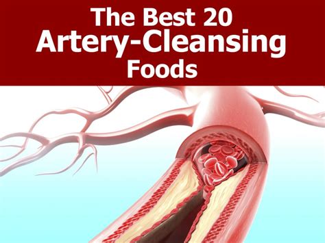 artery cleansing foods