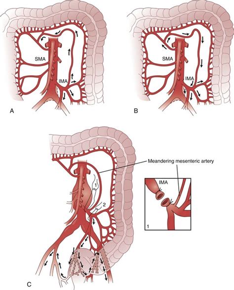 colon and rectum thoracic key