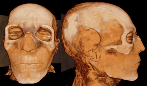 Tech Wizardry Solves Mysteries Of Egypt’s Royal Mummies