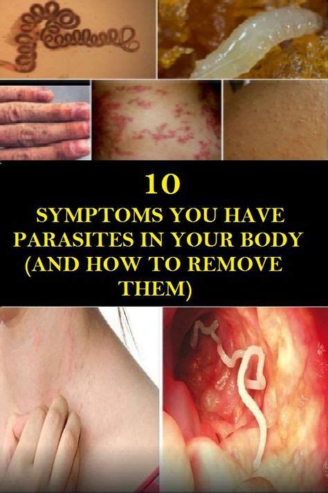 10 Symptoms You Have Parasites In Your Body And How To Remove Them