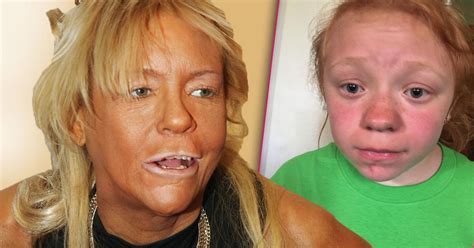Tan Mom Patricia Krentcil Is Angry Her Daughter Got Sunburn At School