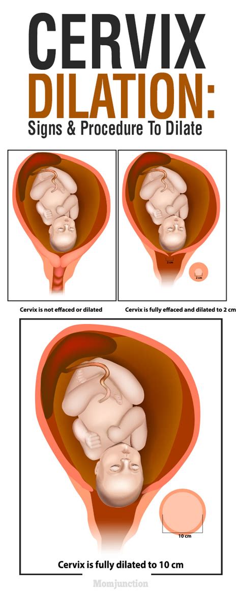 cervix dilation signs  procedure  dilate