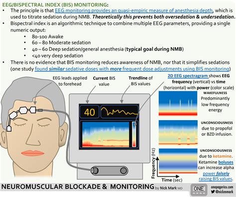 eegbispectral index bis monitoring neuromuscular grepmed