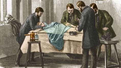 the pioneering surgeons who cleaned up filthy hospitals bbc future