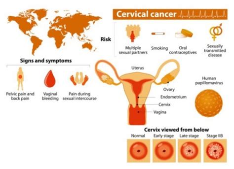 most women miss these early signs of cervical cancer health living solution