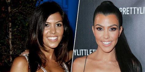 Kourtney Kardashian’s Plastic Surgery Makeover Exposed