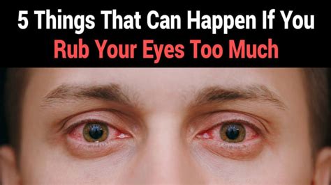 scientists explain 5 things that can happen if you rub your eyes too much