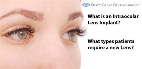 intraocular lens implant  types  patients require