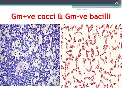 Ppt Bacterial Staining Powerpoint Presentation Id 24802