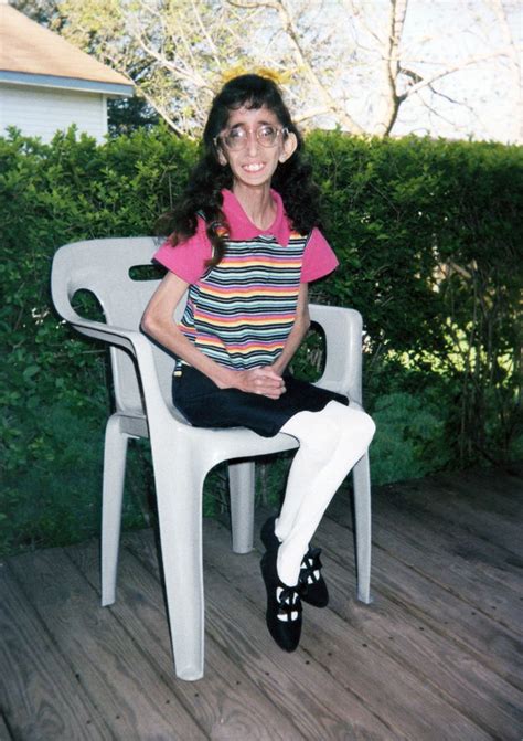 how being called the world s ugliest woman transformed her life
