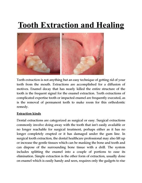 tooth extraction  healing  vi dental center issuu