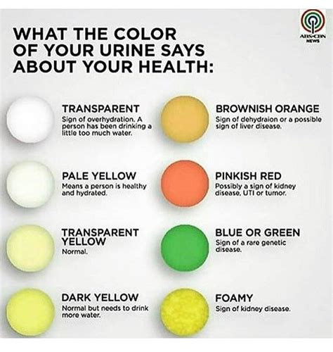 which one are you im between pale transparent yellow