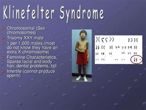 Ppt Genetic Disorders Powerpoint Presentation Free