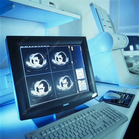 ct scans stock image  science photo library