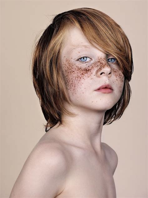 Beautiful Portraits Of Freckled People –