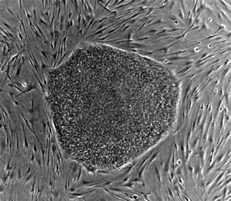 filehuman embryonic stem cell colony phasejpg wikipedia