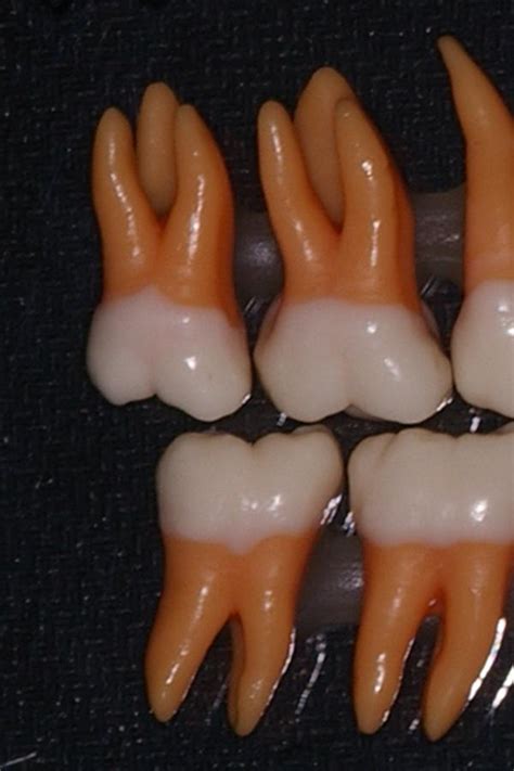 molar   dentist